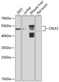 Anti-CRLF2 antibody used in Western Blot (WB). GTX64541