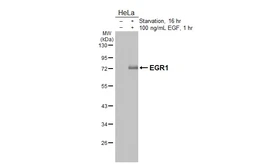Anti-EGR1 antibody [HL5186] used in Western Blot (WB). GTX645438