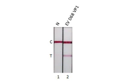 Anti-Enterovirus D68 VP1 antibody [HL5334] used in Lateral Flow (Lateral Flow). GTX645812