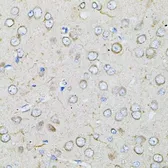 Anti-Bestrophin 1 antibody used in IHC (Paraffin sections) (IHC-P). GTX64583