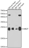 Anti-UBE2T antibody used in Western Blot (WB). GTX64589