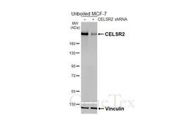 Anti-CELSR2 antibody [HL5390] used in Western Blot (WB). GTX645958