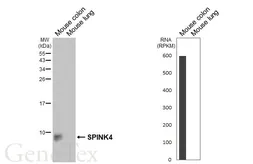 Anti-SPINK4 antibody [HL5418] used in Western Blot (WB). GTX645986