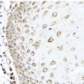 Anti-RAC2 antibody used in IHC (Paraffin sections) (IHC-P). GTX64601