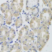 Anti-GPT antibody used in IHC (Paraffin sections) (IHC-P). GTX64602