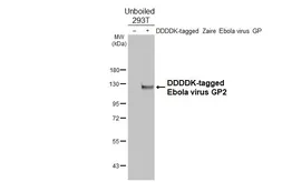 Anti-Ebola virus GP2 antibody [HL5494] used in Western Blot (WB). GTX646158