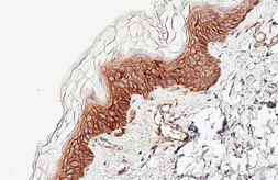 Anti-Claudin 1 antibody [HL5538] used in IHC (Paraffin sections) (IHC-P). GTX646212