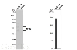 Anti-NFIB antibody [HL5571] used in Western Blot (WB). GTX646245