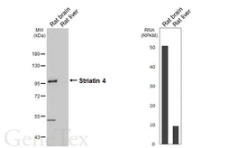 Anti-Striatin 4 antibody [HL5583] used in Western Blot (WB). GTX646265
