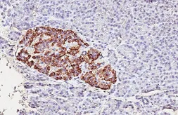 Anti-Retinoid X Receptor alpha antibody [HL5604] used in IHC (Paraffin sections) (IHC-P). GTX646286