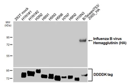 Anti-Influenza B virus Hemagglutinin (HA) antibody [HL5631] used in Western Blot (WB). GTX646320