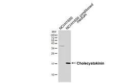 Anti-Cholecystokinin antibody [HL5640] used in Western Blot (WB). GTX646329