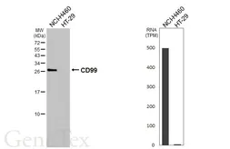 Anti-CD99 antibody [HL5668] used in Western Blot (WB). GTX646477