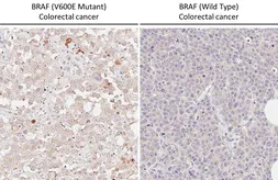 Anti-B-Raf (V600E Mutant) antibody [HL5673] used in IHC (Paraffin sections) (IHC-P). GTX646482