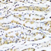 Anti-GnRH1 antibody used in IHC (Paraffin sections) (IHC-P). GTX64650