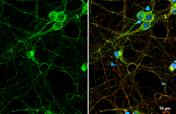 Anti-mGluR1 antibody [HL5720] used in Immunocytochemistry/ Immunofluorescence (ICC/IF). GTX646551