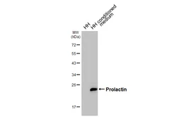 Anti-Prolactin antibody [HL5726] used in Western Blot (WB). GTX646677
