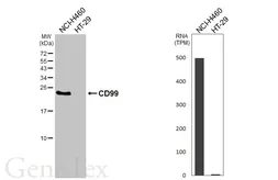 Anti-CD99 antibody [HL5738] used in Western Blot (WB). GTX646689