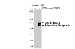 Anti-Rabies virus Glycoprotein antibody [HL5746] used in Western Blot (WB). GTX646697