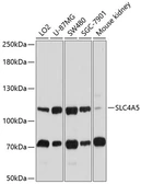 Anti-SLC4A5 antibody used in Western Blot (WB). GTX64690