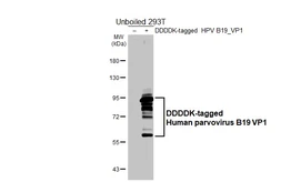 Anti-Human parvovirus B19 VP1 antibody [HL5828] used in Western Blot (WB). GTX647146