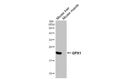 Anti-GPX1 antibody [HL5845] used in Western Blot (WB). GTX647163