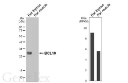 Anti-BCL10 antibody [HL5868] used in Western Blot (WB). GTX647192