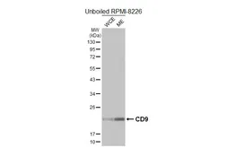 Anti-CD9 antibody [HL5880] used in Western Blot (WB). GTX647204