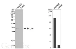 Anti-BCL10 antibody [HL5903] used in Western Blot (WB). GTX647227