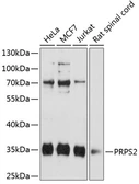 Anti-PRPS2 antibody used in Western Blot (WB). GTX64723