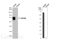 Anti-CD155 antibody [HL5911] used in Western Blot (WB). GTX647236
