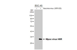 Anti-Mpox virus H6R antibody [HL5928] used in Western Blot (WB). GTX647253