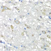 Anti-CBR3 antibody used in IHC (Paraffin sections) (IHC-P). GTX64745