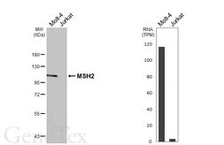 Anti-MSH2 antibody [HL5971] used in Western Blot (WB). GTX647585