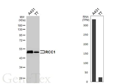 Anti-RCC1 antibody [HL6011] used in Western Blot (WB). GTX648085