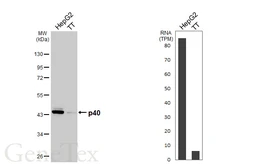 Anti-p40 antibody [HL6012] used in Western Blot (WB). GTX648086