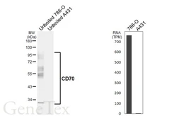 Anti-CD70 antibody [HL6015] used in Western Blot (WB). GTX648089