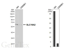 Anti-SLC19A2 antibody [HL6025] used in Western Blot (WB). GTX648099