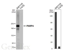 Anti-PARP4 antibody [HL6034] used in Western Blot (WB). GTX648108