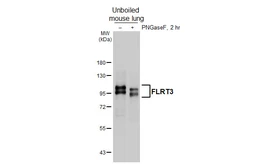 Anti-FLRT3 antibody [GT396] used in Western Blot (WB). GTX648115