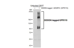 Anti-GPR115 antibody [HL6055] used in Western Blot (WB). GTX648134