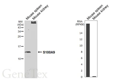 Anti-S100A9 antibody [HL6069] used in Western Blot (WB). GTX648148