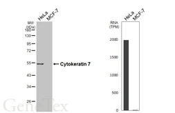 Anti-Cytokeratin 7 antibody [HL6074] used in Western Blot (WB). GTX648153