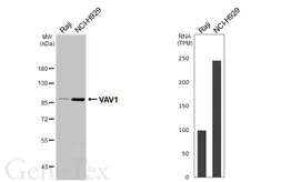 Anti-VAV1 antibody [HL6129] used in Western Blot (WB). GTX648214