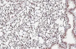 Anti-Nucleophosmin antibody [HL6169] used in IHC (Paraffin sections) (IHC-P). GTX648256