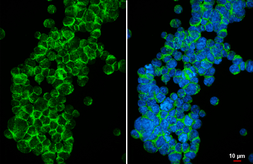 Anti-Cannabinoid receptor 2 antibody [HL6187] used in Immunocytochemistry/ Immunofluorescence (ICC/IF). GTX648279