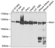 Anti-PKN1 antibody used in Western Blot (WB). GTX64829