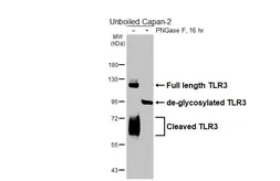 Anti-TLR3 antibody [HL6206] used in Western Blot (WB). GTX648298