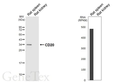 Anti-CD20 antibody [HL6217] used in Western Blot (WB). GTX648309