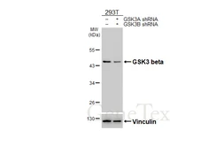 Anti-GSK3 beta antibody [HL6229] used in Western Blot (WB). GTX648321
